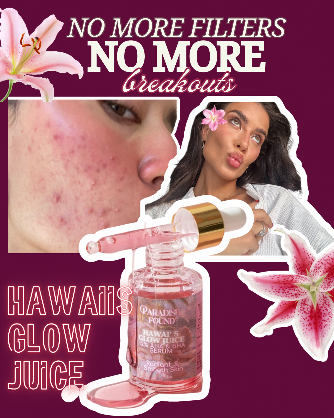 Hawaii's Glow Juice • Anti-acne & anti blemish