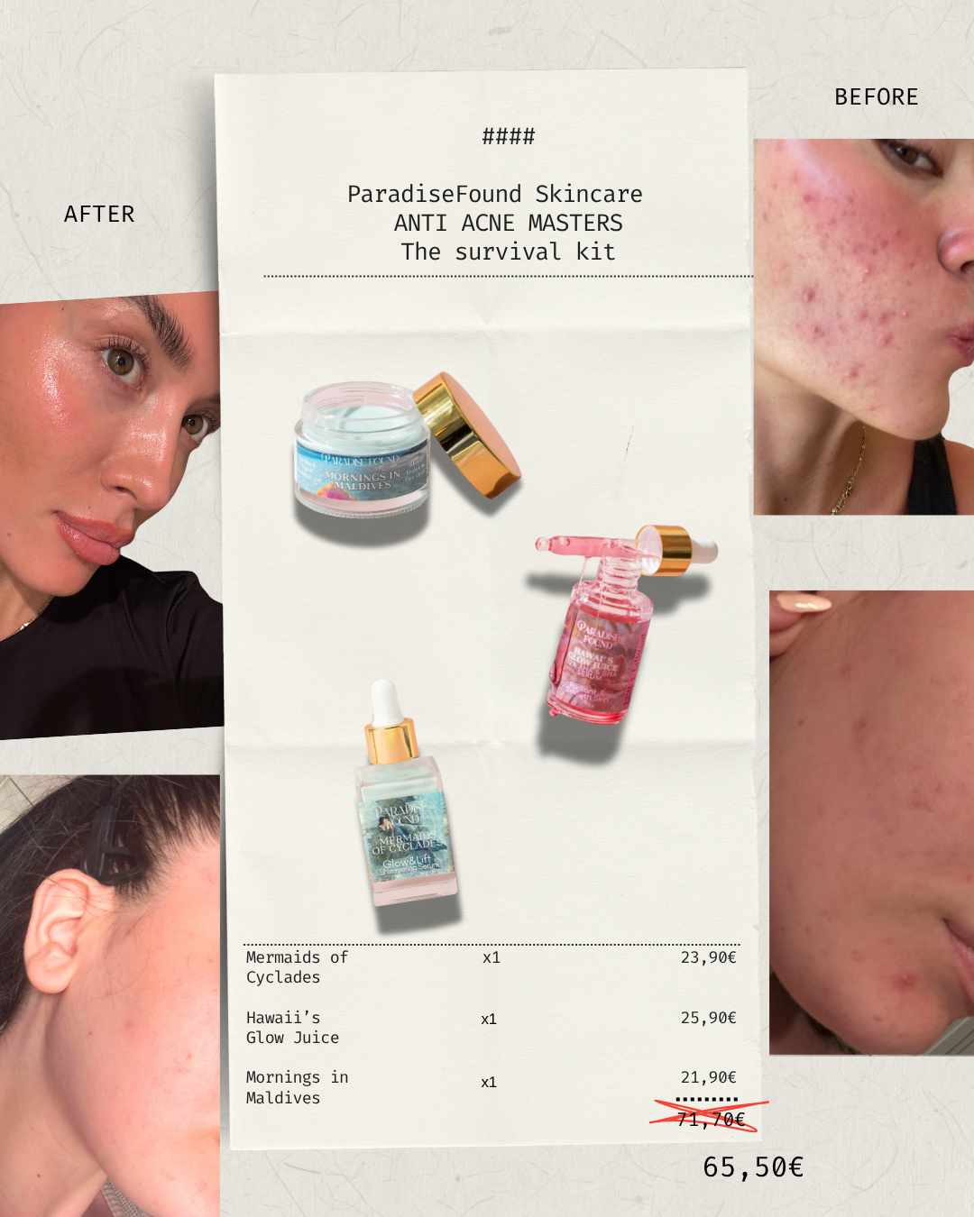 Anti Acne Masters